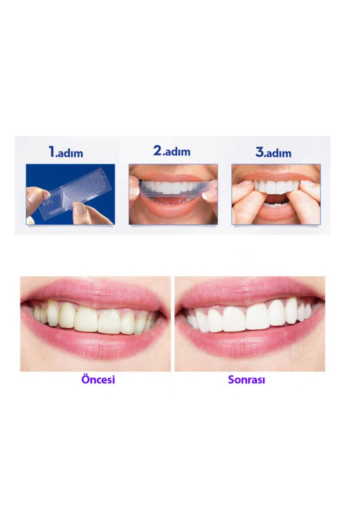 ست نوار چسبی سه بعدی سفید کننده دندان برند CREST